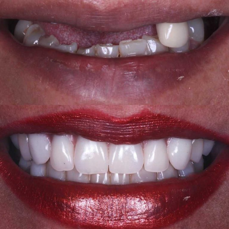 smiles1