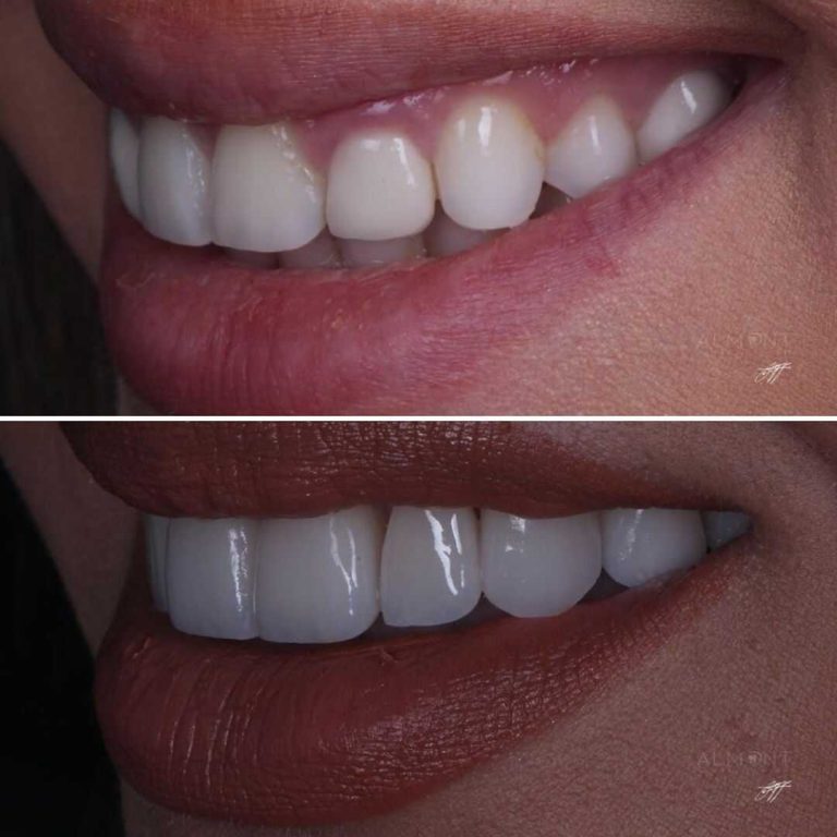 smiles10