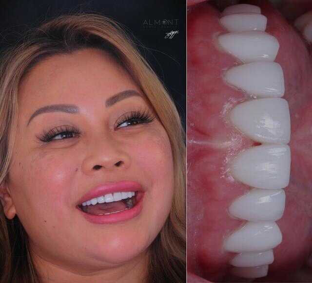 smiles6