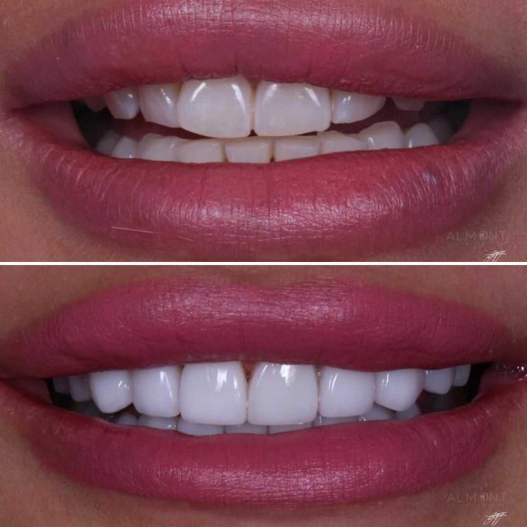 smiles7