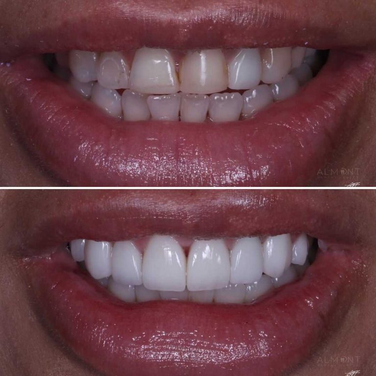 smiles9