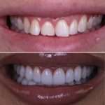 WELCOME TO FABULOUS ALMONT Smile with confidence