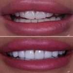 Your SMILE will always be your best OUTFIT